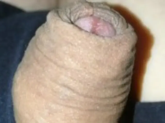 Grower slowly erects, no hands flaccid, foreskin with pre-cum drop at end.